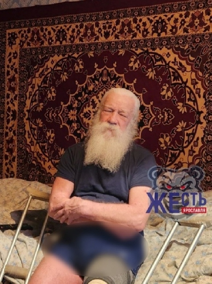В Ярославле «дедушке с голым торсом» нужен бионический протез