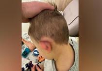 Выяснились подробности нападения нескольких ротвейлеров на 4-летнего ребенка в коттеджном поселке «Мининская поляна» в Раменском городском округе