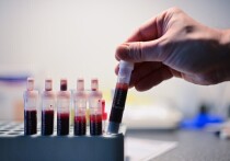 Исследование показывает, что анализ крови может выявить признаки болезни Альцгеймера "за десятилетия до появления симптомов"