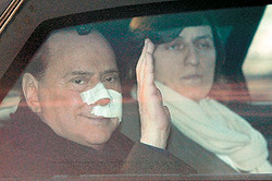 Раны Берлускони залечат в Швейцарии