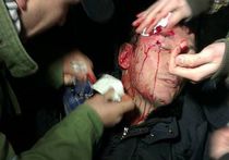 «Беркут» отправил Юрия Луценко в реанимацию