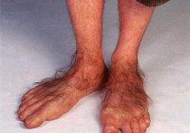 Ученый из США предложил странную теорию возникновения ног