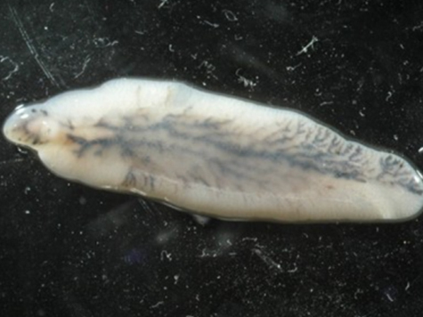 Своеобразный рекорд поставил москвич, который более 30 лет (!) носил в себе паразита — печеночного сосальщика