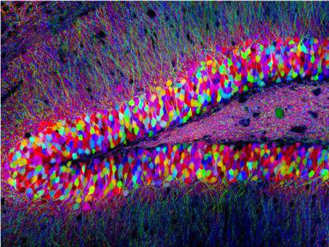 Американским ученым впервые удалось имплантировать в мозг мыши искусственные воспоминания