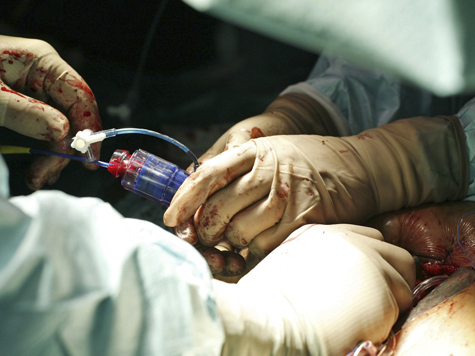 Новые правила констатации смерти ущемили права трансплантологов

