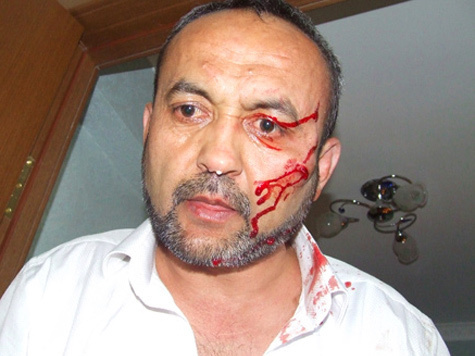 Правозащитник центра “Мемориал” Бахром Хамроев был избит неизвестными у собственного дома