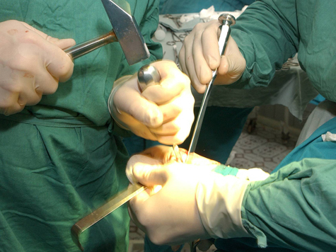 Хирургов могут привлечь к уголовной ответственности