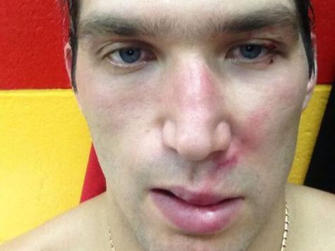 Хоккеист получил травму лица в матче против «Виннипега»
