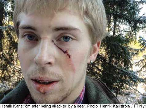 Хенрик Карлстрём получил рваные раны руки, глубокие царапины на лице и затылке
