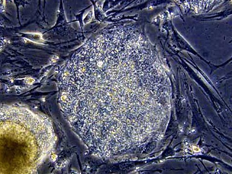 Ученым удалось впервые получить чистые эмбриональные стволовые клетки