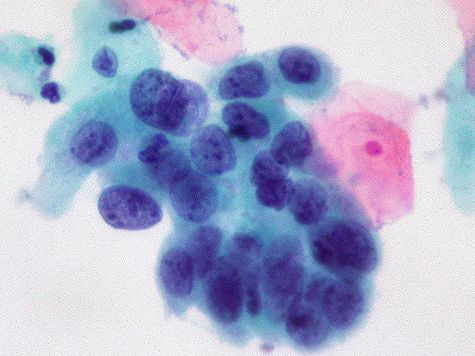 Результаты исследования опубликованы на сайте журнала "Nature Cell Death and Differentiation"