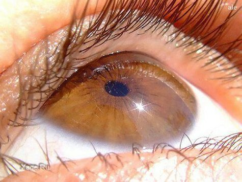 Ученые нашли способ лечить травмы глаз с помощью стволовых клеток