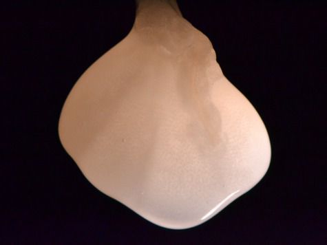 Команда Харальда Отта уже начала тестировать свой метод на почках свиньи и человека