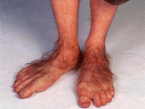 Грегори Реталлак из Орегонского университета предложил новую теорию формирования конечностей у живых существ