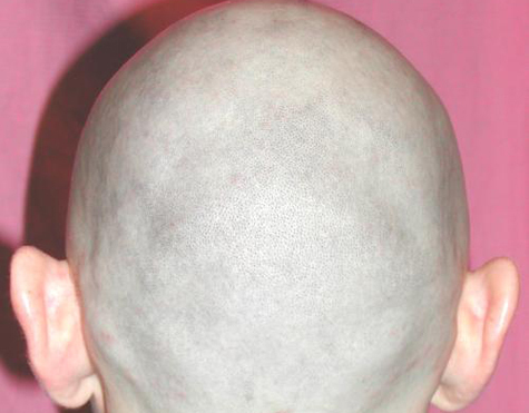 Ген, отвечающий за рост волос, нашли специалисты Института общей генетики РАН