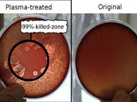 Ученые выяснили, что холодные плазменные струи уничтожают большое количество устойчивых к лекарствам инфекций.