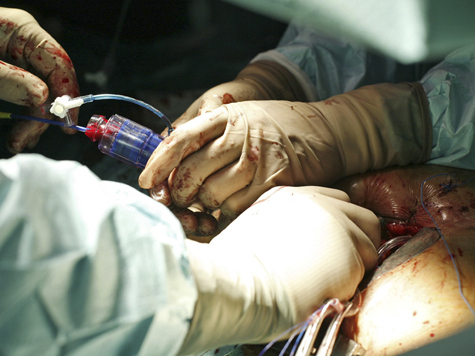 Уникальную операцию на «загнившем» сердце сделали на днях российские кардиологи
