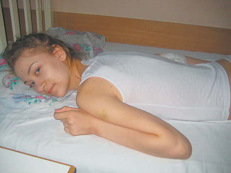 Операция сколиоза позволяет детям “подрасти” иногда до 12 см

