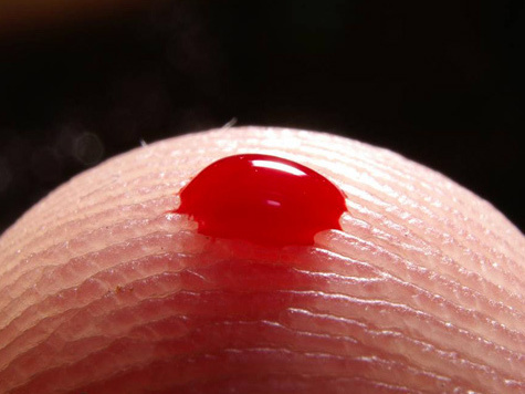 Своеобразный маркер смерти обнаружили в крови шведские ученые
