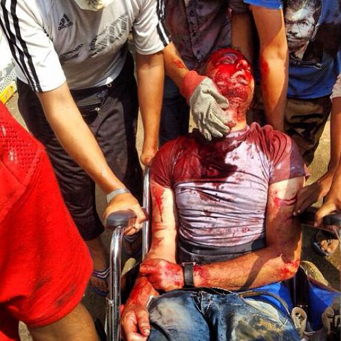 Трагические фото из Египта в Instagram. БТРы у отелей, жертвы и стрельба