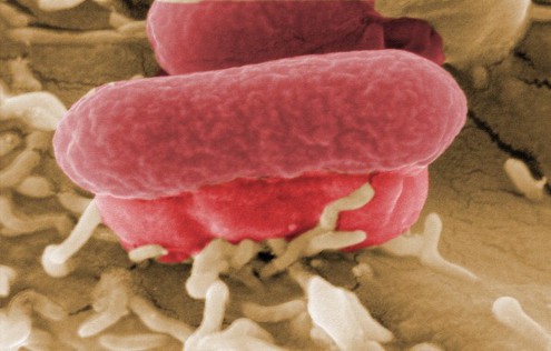Страшная палочка E.coli