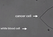 Раковые клетки от крови можно отделять при помощи звука