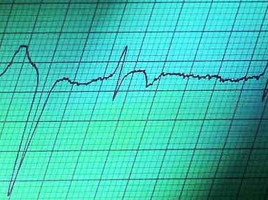 Больную с инфарктом миокарда пытались вылечить от остеохондроза