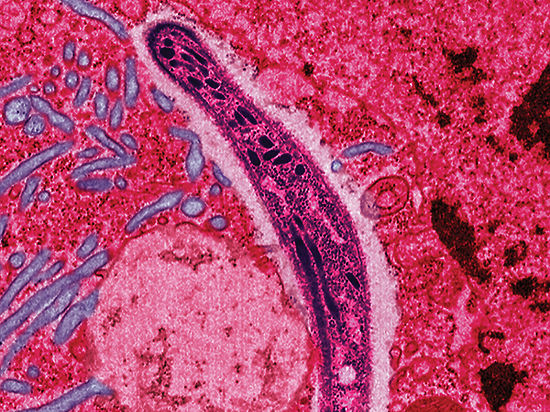 Негатив на фоне свежей новости о том, что ВОЗ одобрила первый экспресс-тест для выявления болезни, вызванной вирусом Эбола