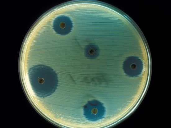 Разрушение бактериальных оболочек может навсегда покончить с устойчивостью бактерий к антибиотикам
