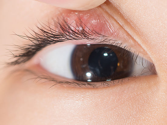 Воспаление глаз зимой случается гораздо чаще, чем в другие сезоны
